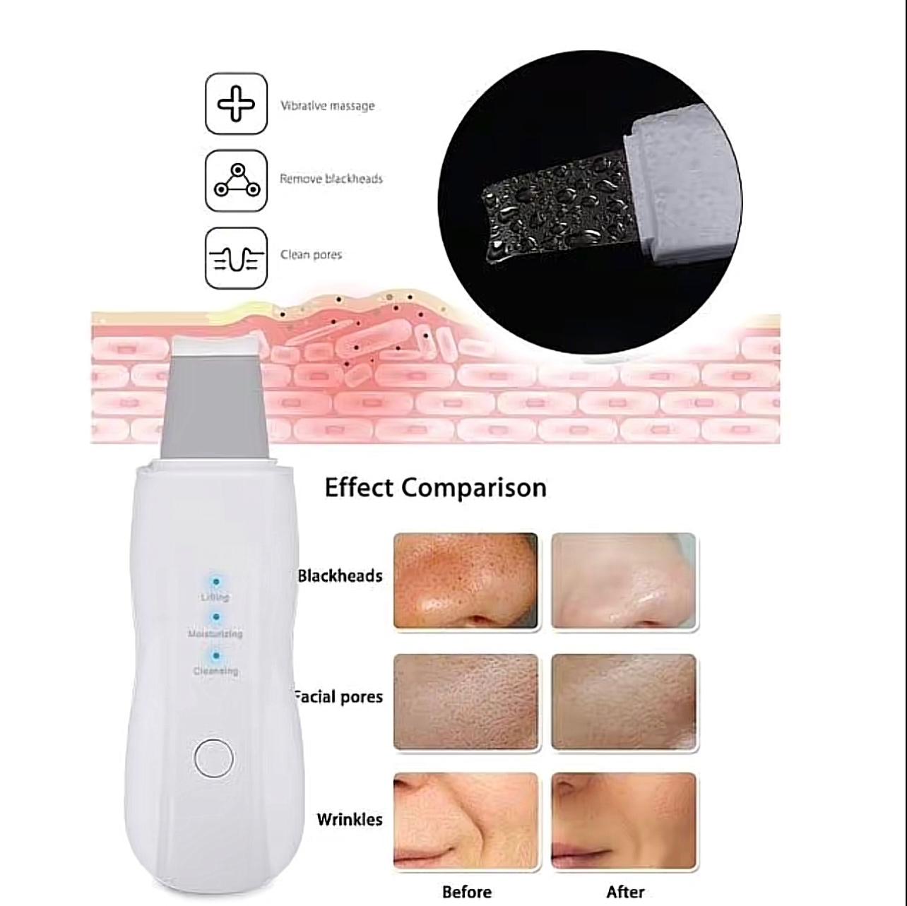 CasaDuzzle™ Electric Blackhead Pore Remover