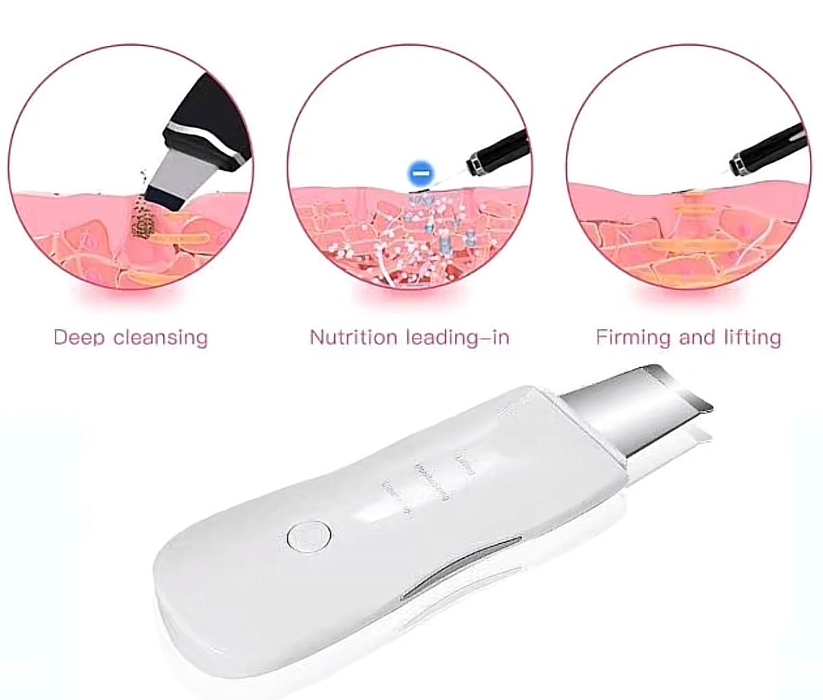 CasaDuzzle™ Electric Blackhead Pore Remover