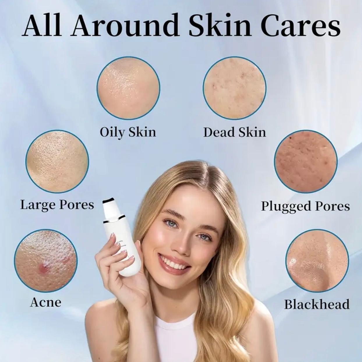 CasaDuzzle™ Electric Blackhead Pore Remover