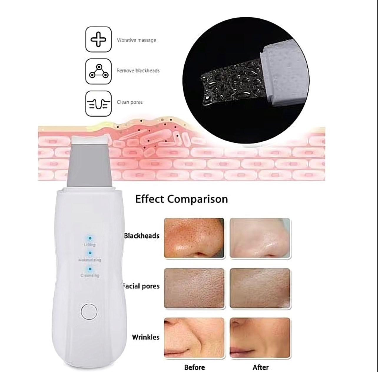 CasaDuzzle™ Electric blackhead pore remover