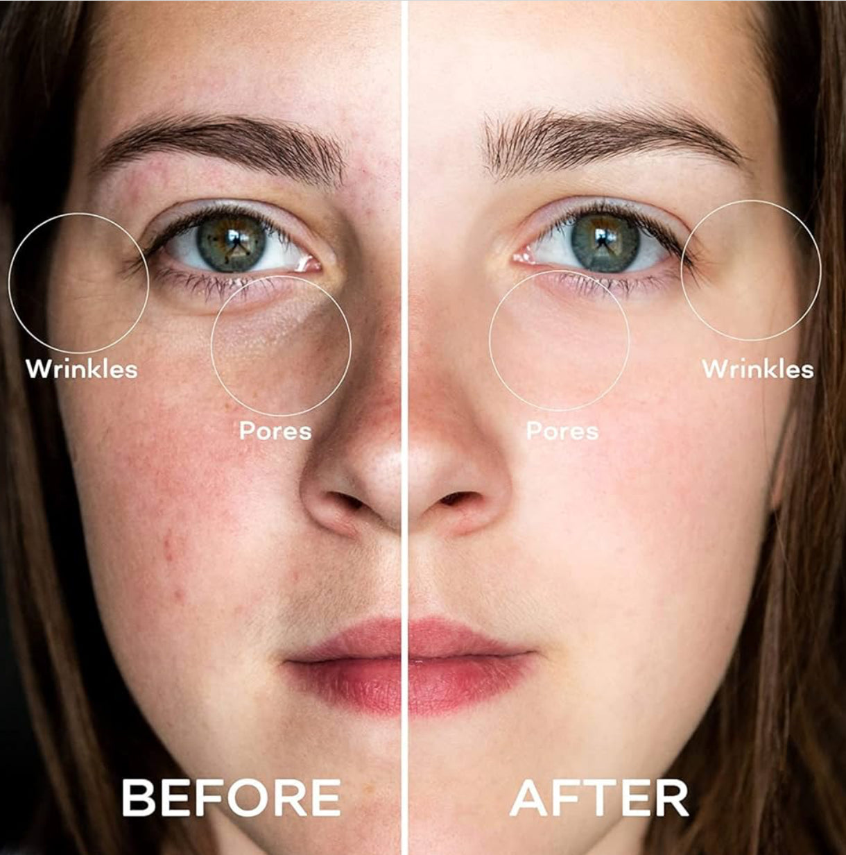 CasaDuzzle™ 2 in 1 Ice Roller Massager