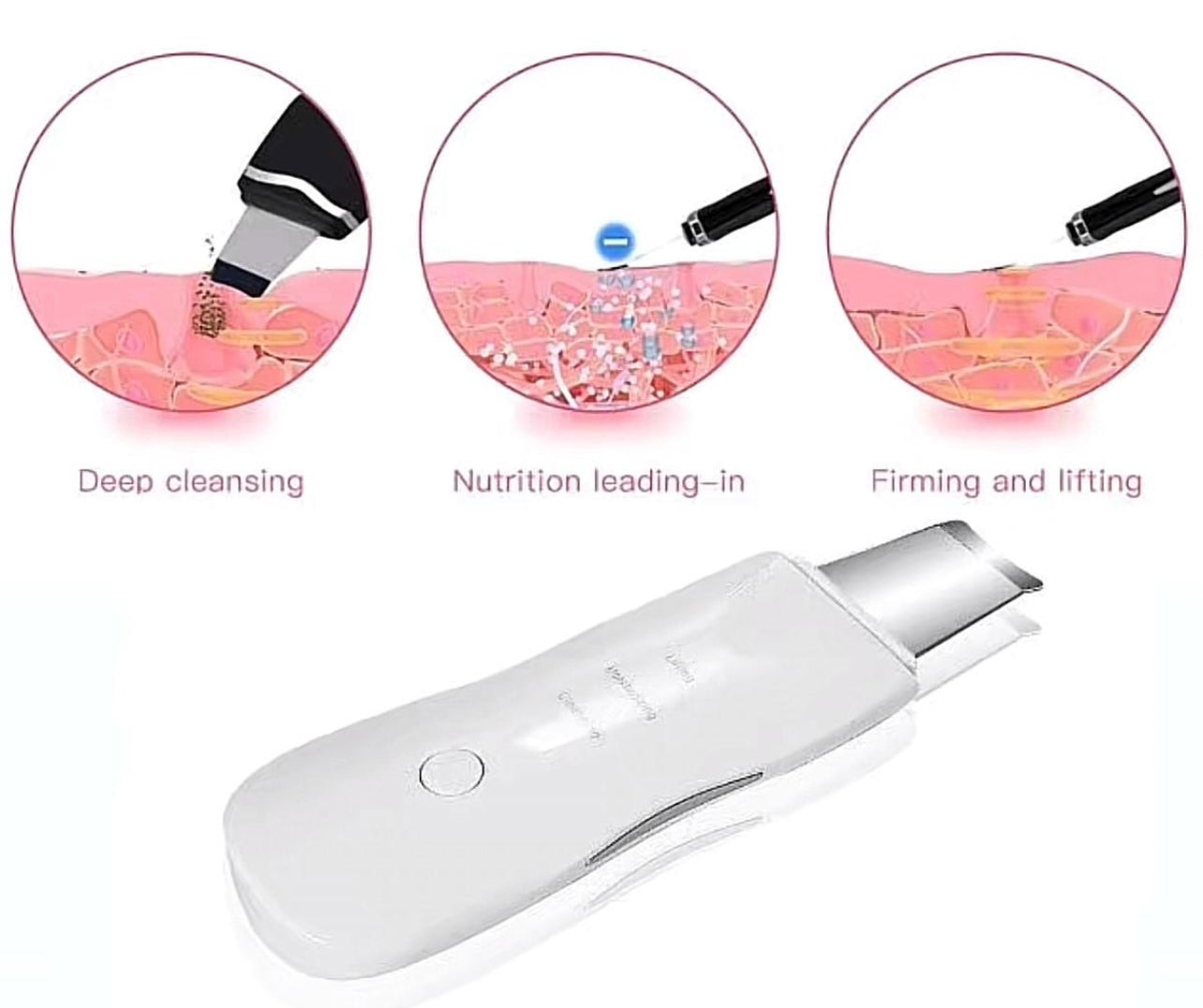 CasaDuzzle™ Electric blackhead pore remover