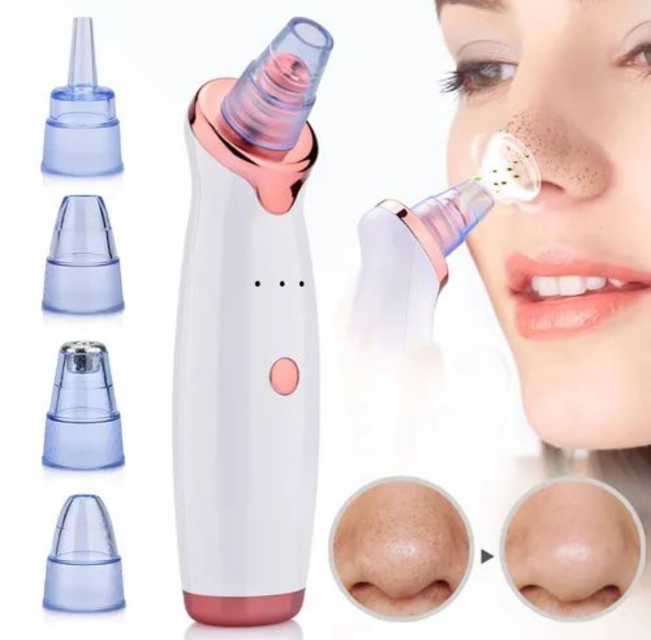 CasaDuzzle™ Vacuum Pore Cleaner