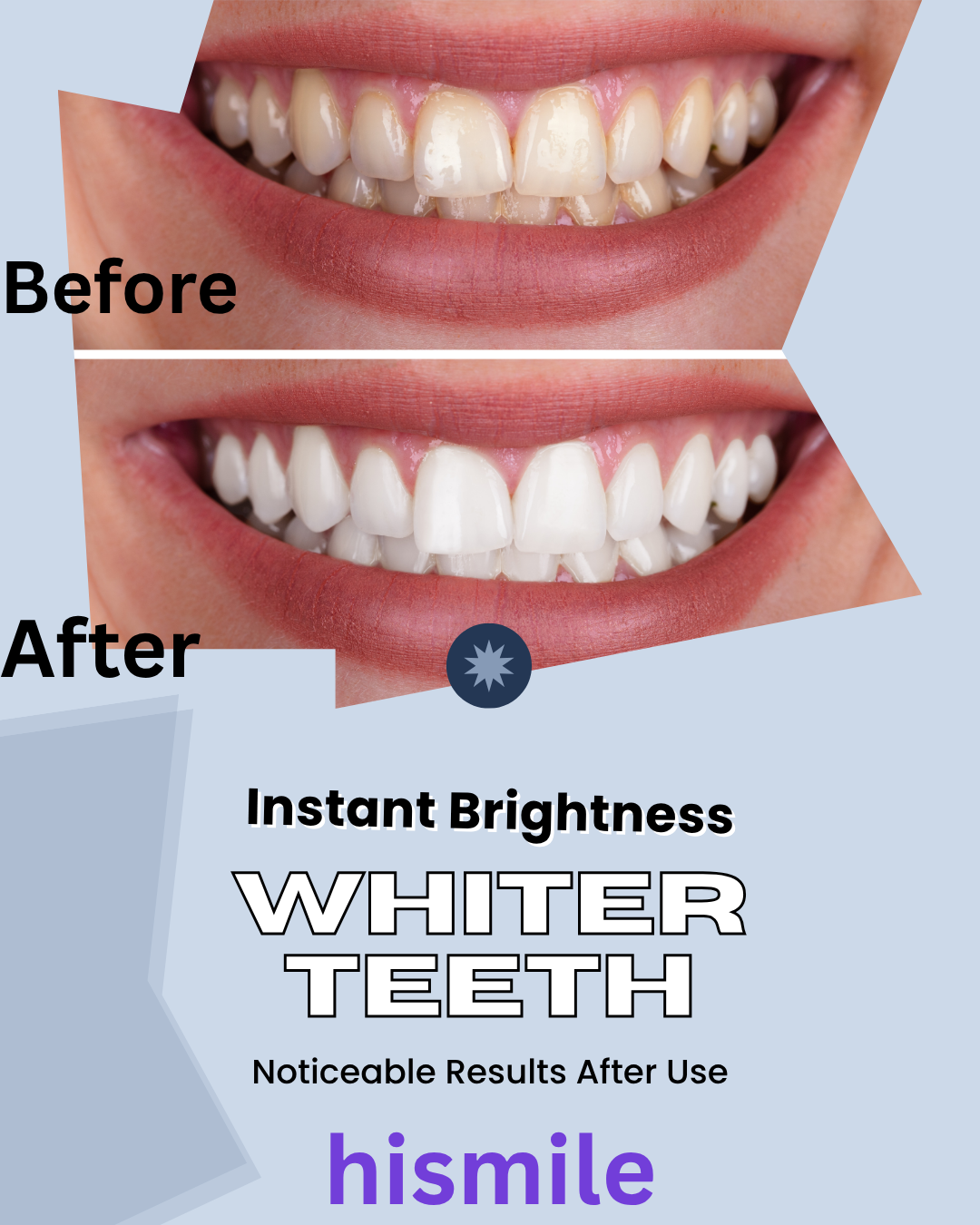 CasaDuzzle™ Teeth Whitening